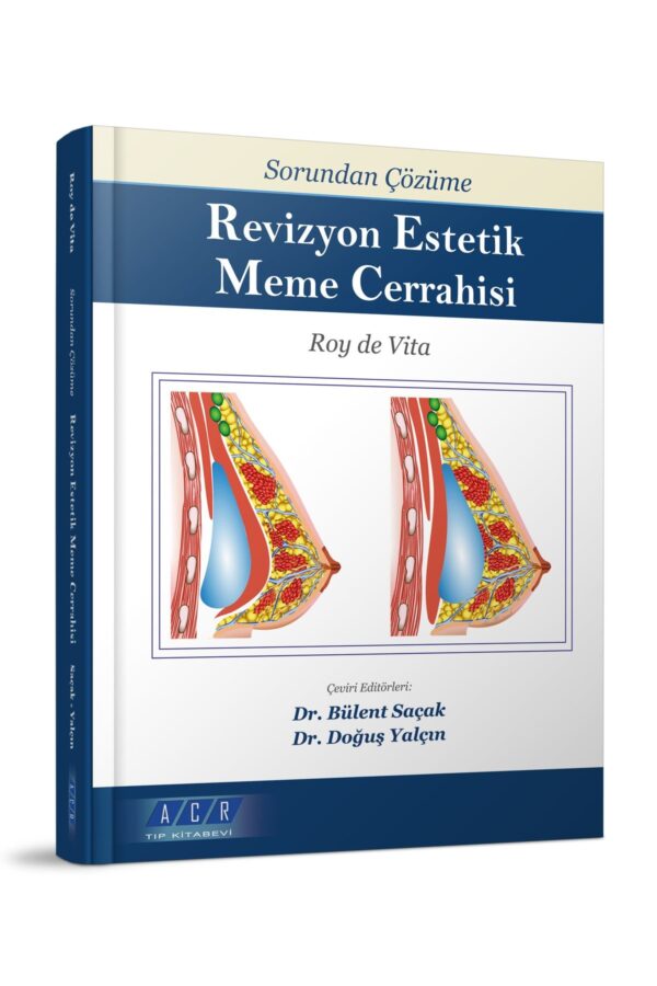 Sorundan, Çözüme Revizyon Estetik Meme Cerrahisi - Görsel 2