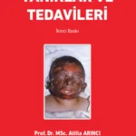 Yanıklar ve Tedavileri