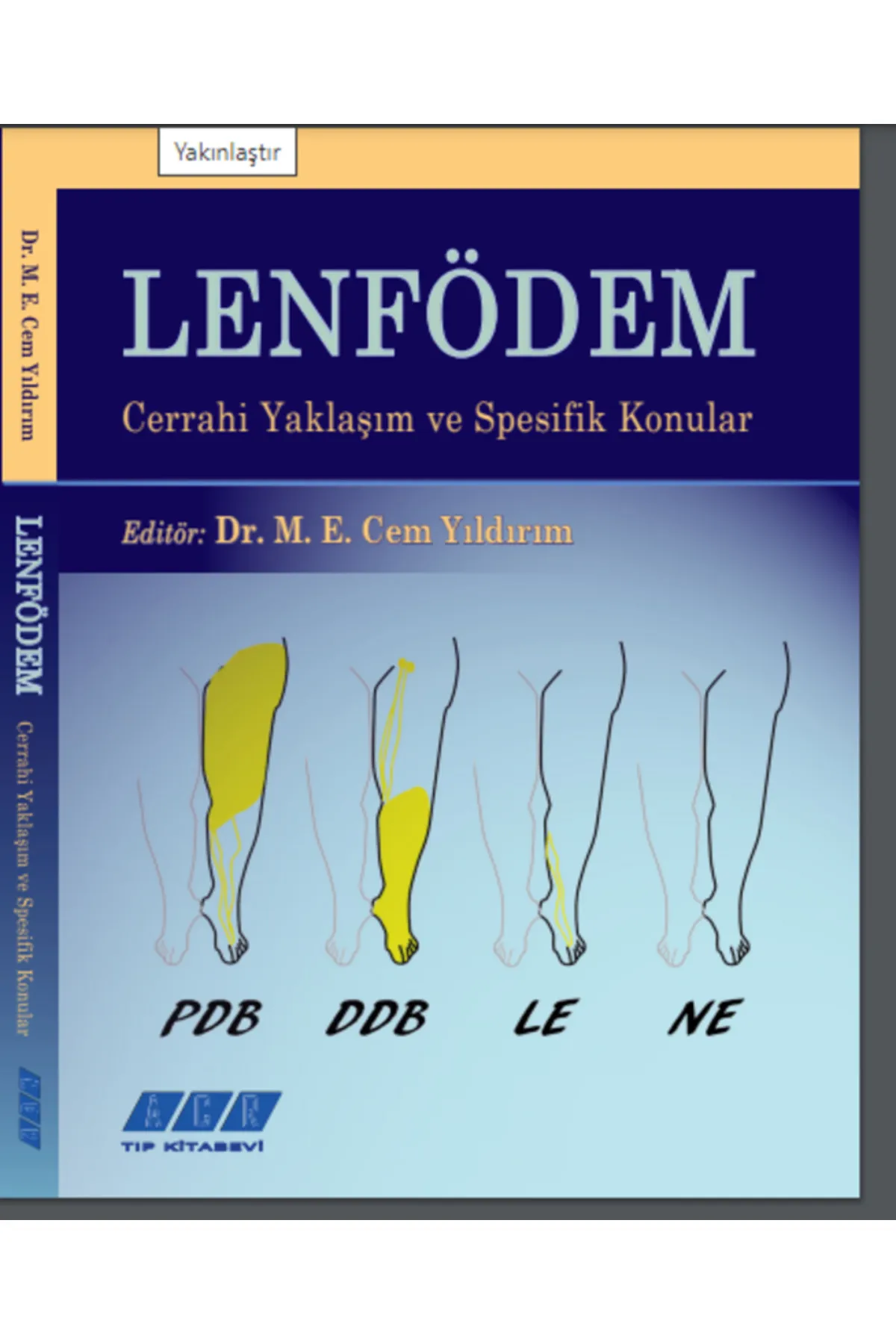 659da50bb9c50-1-1.webp Lenfödem - Cerrahi Yaklaşım ve Spesifik Konular - Görsel 1