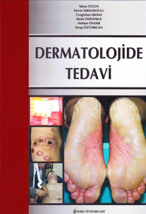 Dermatolojide Tedavi - Görsel 2