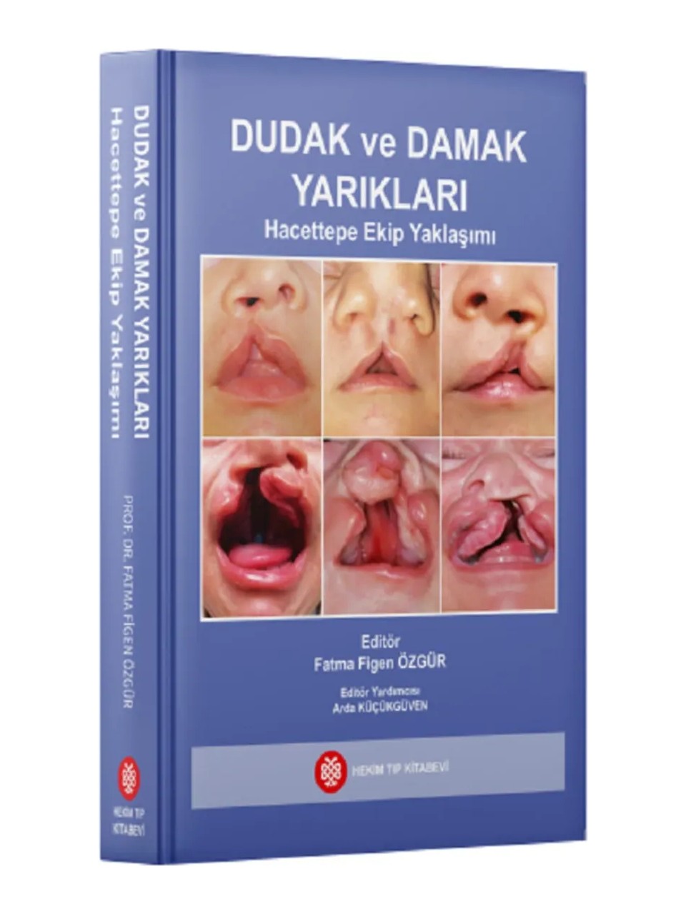 694872a6d1898-694872a7769ad-1.jpg Dudak ve Damak Yarıkları Hacettepe Ekip Yaklaşımı - Fatma Figen Özgür - Görsel 1