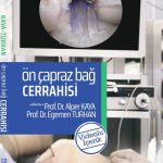 Ön Çapraz Bağ Cerrahisi